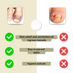 Adhesive toenail support strips for curved nails and daily care