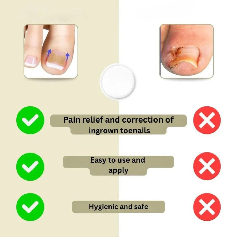 Klebende Nagelstützen für geschwungene Nägel und tägliche Pflege