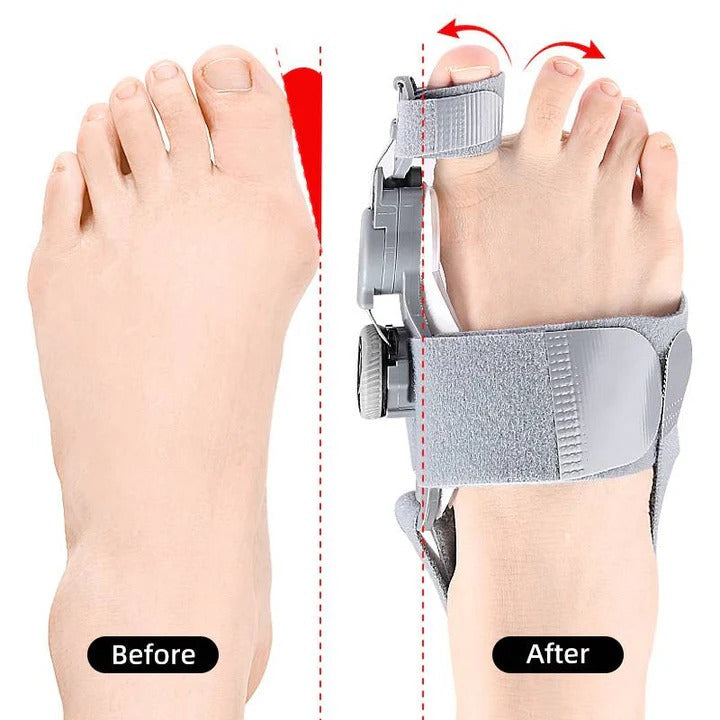 Adjustable toe spacer for optimal foot alignment