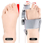 Adjustable toe separator for optimal foot alignment