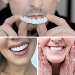 Aesthetic Tooth Covers for Adults, 2-Piece Set