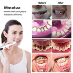 Rechargeable Teeth Cleaning Kit with LED Lighting