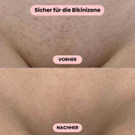 Gentle Women's Intimate Shaver – Shaving without Irritation