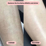 Gentle Women's Intimate Shaver – Shaving without Irritation