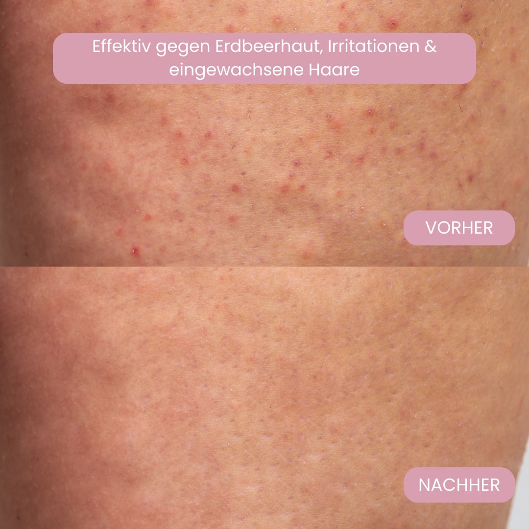 Sanfter Intimrasierer für Frauen – Für eine perfekte Rasur