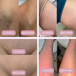 Sanfter Intimrasierer für Frauen – Für eine perfekte Rasur