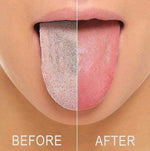 Mundschmeichler – Stainless Steel Tongue Cleaner