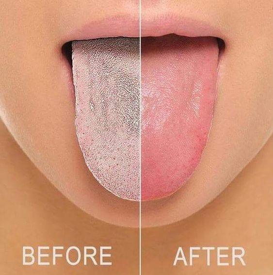 Mundschmeichler – Stainless Steel Tongue Cleaner