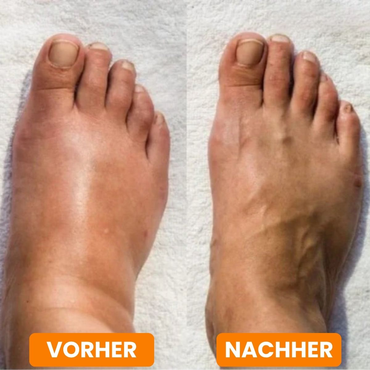 Entspannendes EMS-Fußmassagegerät für Wohlbefinden